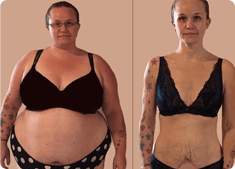 Lipo Jelly customer reviews